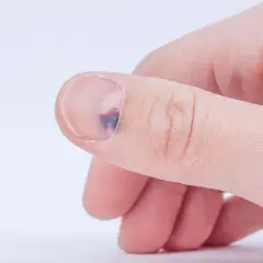 Co oznacza jeden czarny paznokieć? Przyczyny i leczenie