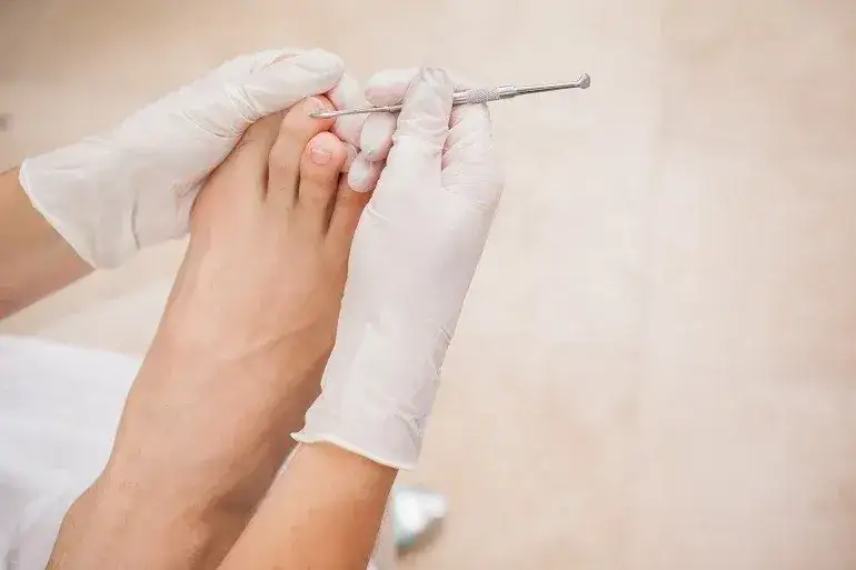 Zdjęcie Jak dbać o paznokcie u nóg? 8 skutecznych technik pielęgnacji